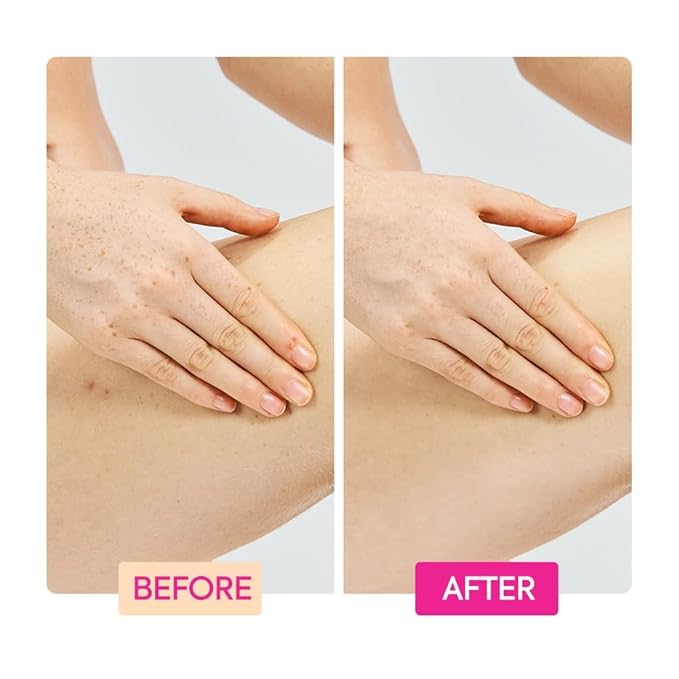 MAKARI IYKYK Ginger Extract, Tranexamic Acid & Retinol Body Toning Cream 2 Pack | Firming Body Lotion for Women | Helps Improve the Look of Smoothness | No Fragrance | Paraben & Sulfate-Free