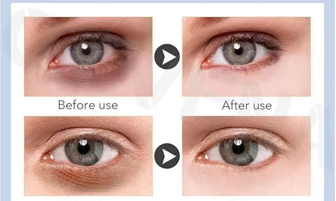 New 2026, Roliac's INSTANT Eyes & Face lift Wrinkle remover Cream, instant results, 25 LARGE 1 ml. (0.34 onces) per Viales, No white residue, Guaranteed results, Anti-aging solution, Last all day.