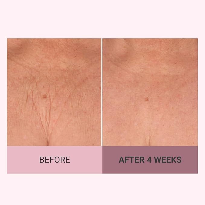 Consult Beaute Champagne Lift Hydrating Firming Body Cream with Pink Pepperslim, Tightens, Tones Crepey Skin, Moisturizer for Dry Skin, Warm Santal, 8 oz.