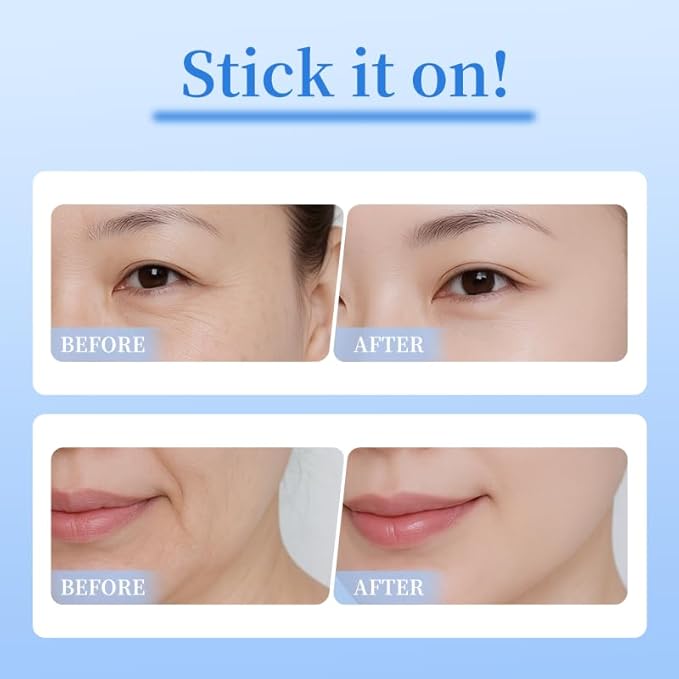 8 pairs PDRN Micro Eye Patches, Under Eye Patches for Puffy eyes, Dark Circles & Wrinkle | Hyaluronic Acid, Kojic Acid, Collagen, Peptides, Vitamin C, Niacinamide - Korean Popular Eye Care
