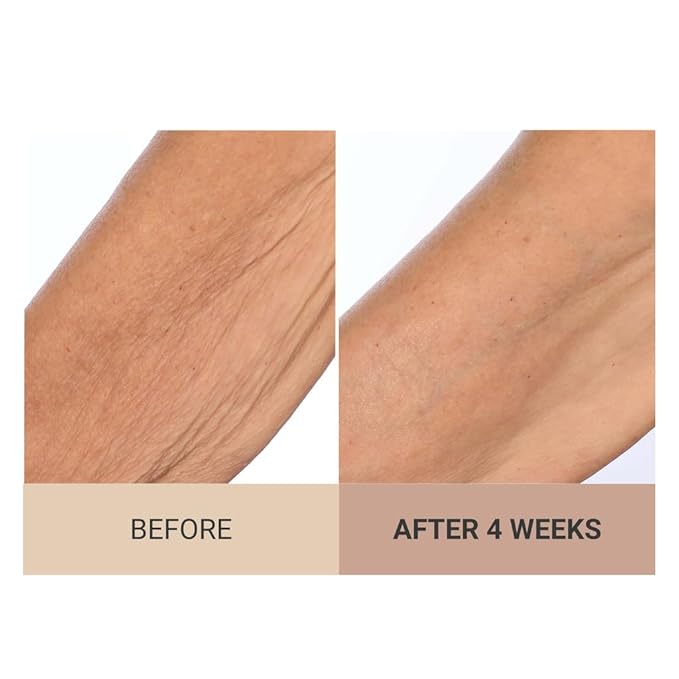 Consult Beaute Unscented Champagne Lift Hydrating Firming Body Cream with Pink Pepperslim, Moisturizer, Tightens Crepey Skin, Tones & Hydrates Dry Skin on Arms & Legs - 8 oz.