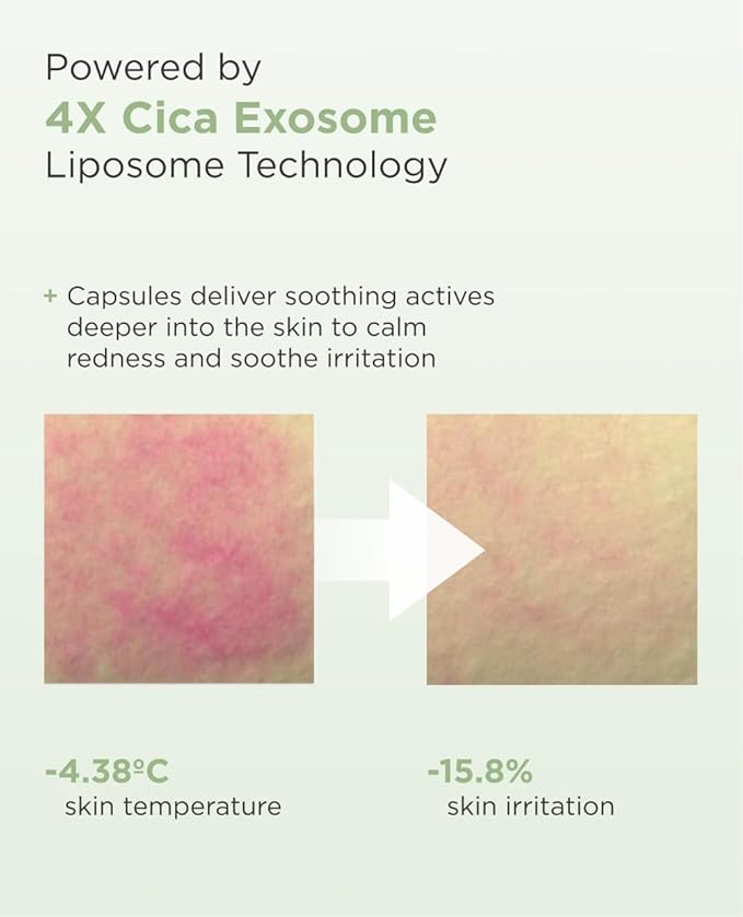 AROCELL Cica Hydrogel PDRN Mask 4 Facial Sheet with Panthenol & Centella Asiatica, Cooling Hydrogel Face Mask for Soothing Calming Hydrating Moisturizing Sensitive Skin Korean Skincare, 25gx4ea