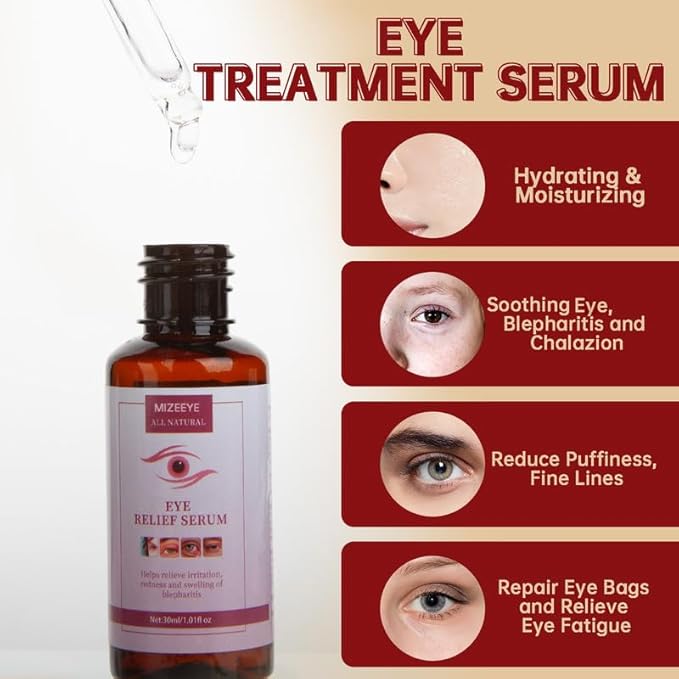 Styes Eye Relief Serum, 30ml Moisturize Blepharitis & Chalazion Remover, Gentle Under Eyelid Serum For Dark Circles, Puffiness.