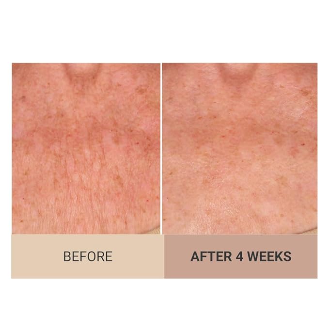 Consult Beaute Unscented Champagne Lift Hydrating Firming Body Cream with Pink Pepperslim, Moisturizer, Tightens Crepey Skin, Tones & Hydrates Dry Skin on Arms & Legs - 8 oz.