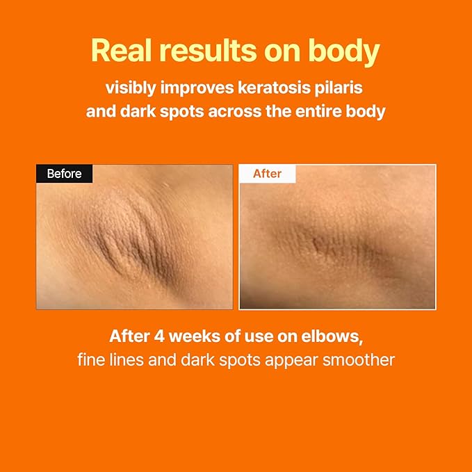 Glow Recovery Booster Set – Retinal Skin Booster Serum + Squalane Skin Booster Moisturizer – Brightening, Anti-Aging & Oil–Moisture Balance Set for Dry, Sensitive Dull Skin