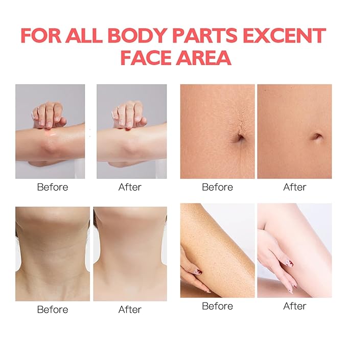 Be Glossy Smoothing Body Serum for Wrinkles - Anti-Aging Formula Infused with Hyaluronic Acid, Vitamin E, Glycerin and Shea Butter - Hydrating & Firming