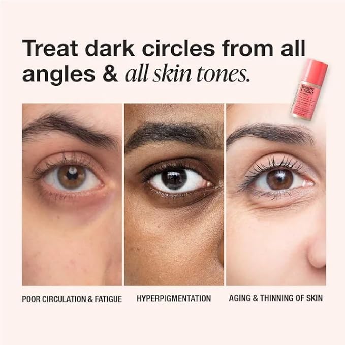 NAPH iNNBEAUTY PROJECT Bright & Tight Dark Circle Firming Eye Cream with Vitamin C & Peptides (0.5 oz / 15 mL) + Bonus Acne Patch (36 Pieces)
