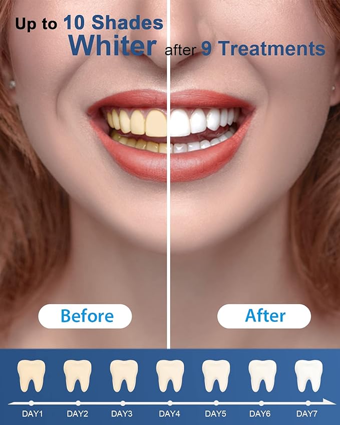 MySmile Teeth Whitening Gel Pen Refill Pack, 3 Non-Sensitive Teeth Whitening Pen, Deluxe Teeth Whitener Dental Grade Tooth Whitening Gel with Carbamide Peroxide for Home, 10 min Fast Result