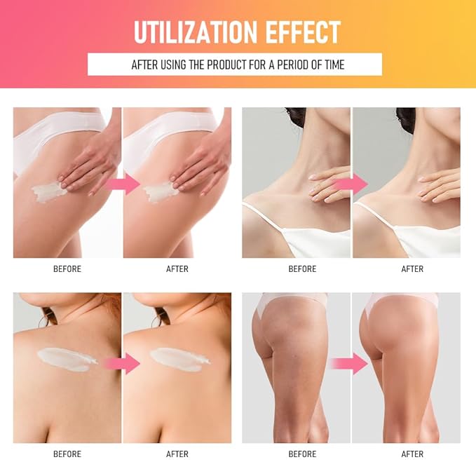 Bum Cream, Moisturizing Body Cream, Body Skin Repair, Bum Cream for All Skin. (Fresh fruity)