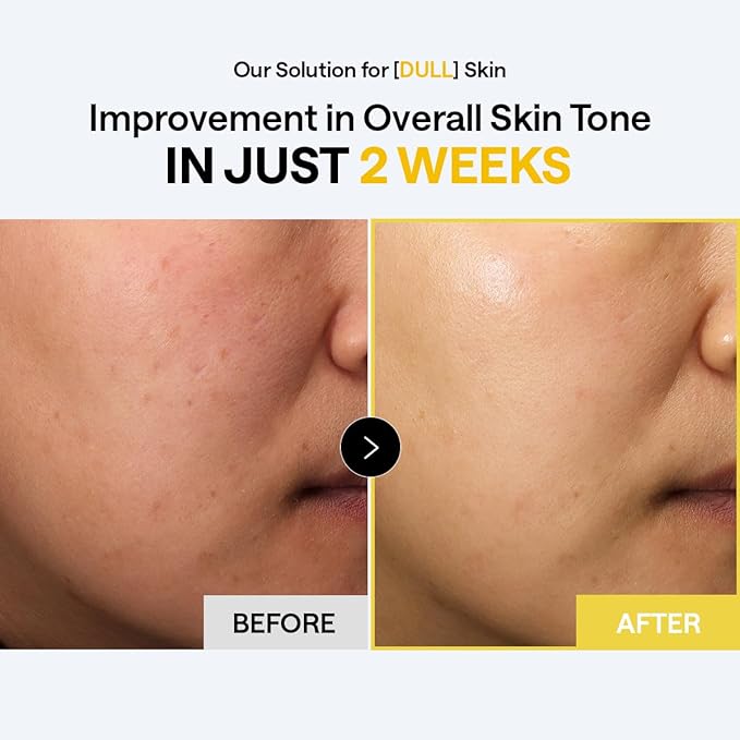 MEDIHEAL Toner Pads [Vitamin C] Bright Toning - Radiance Booster for Clear & Illuminating Skin - Contains Niacinamide for Blemish Care & Skin Toning - Vegan Stretchable Fabric Pads (100 Count)