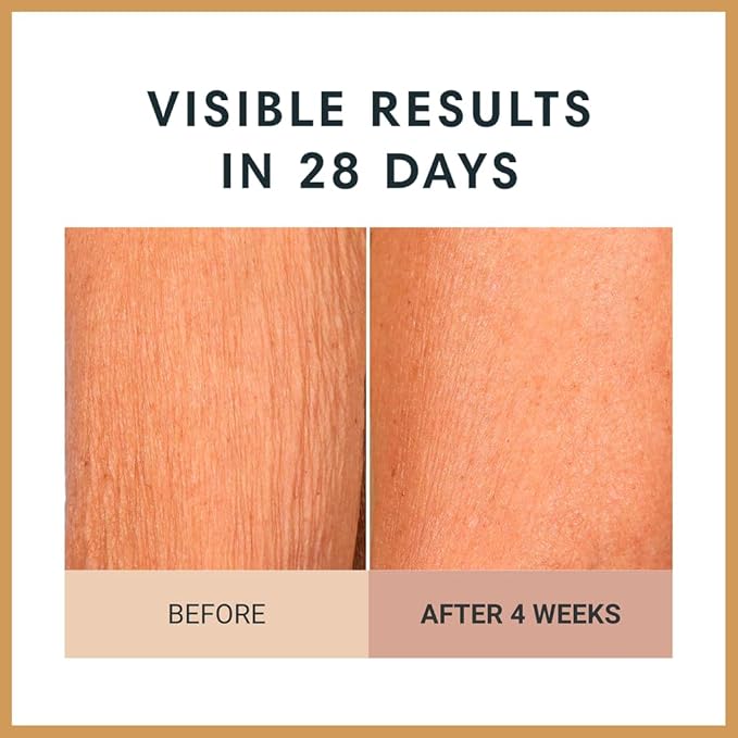 Consult Beaute Unscented Champagne Lift Hydrating Firming Body Cream with Pink Pepperslim, Moisturizer, Tightens Crepey Skin, Tones & Hydrates Dry Skin on Arms & Legs - 8 oz.