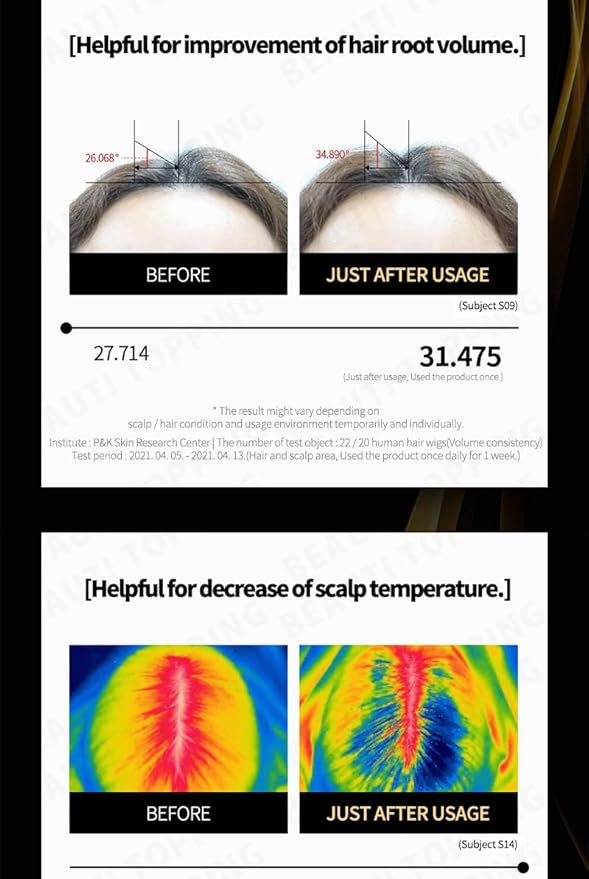 Premium Hair Tonic Synergy Double Up - Hair Thickening Scalp Serum for Anti-Hair Loss, Root Strengthening & Instant Cooling Care for Thinning Hair, 5.41 fl. oz