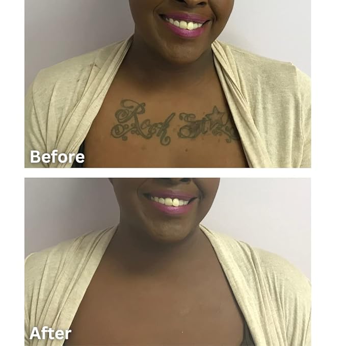 Dermaflage Tattoo Cover Up Makeup (Dark) - Bruise Full Coverage Concealer - Full Coverage Waterproof Concealer for Bruise, Scars & Acne - Smudge Proof Body Makeup Palette with 3 Pro SFX Shades + Brush