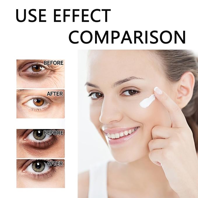 Retinol Eye Stick, retinol Anti-Aging Eyes Stick, Retinols Eye Balm, Relieves Dark Circle and Puffiness, Essence Liquid for Female Eyes Care Mild (1Pcs)