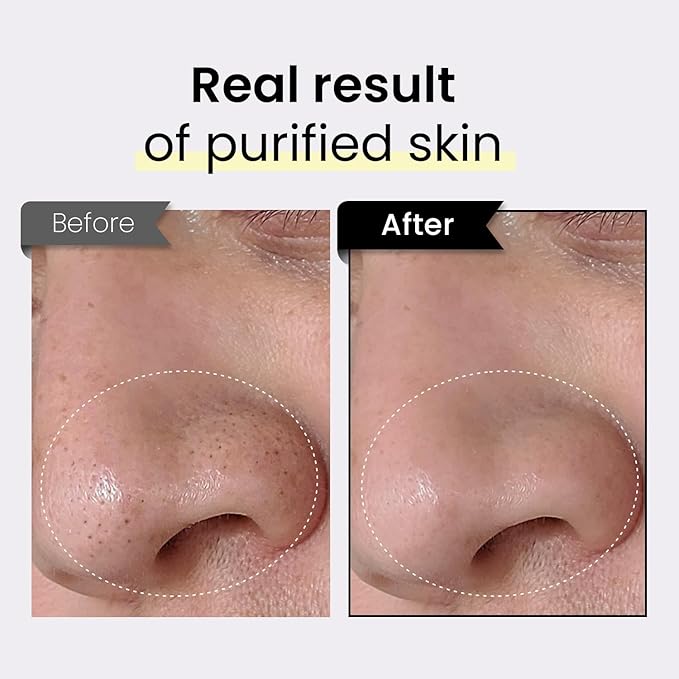 Coxir TXA Black Rice Pore Mask – Korean 3-in-1 Wash-Off Mask Serum| Pore Purifying, Blackhead Care, Hydrating, Skin Toning Treatment with TXA & Black Rice |Vegan K-beuaty Face Mask [50ml/1.69 fl.oz]