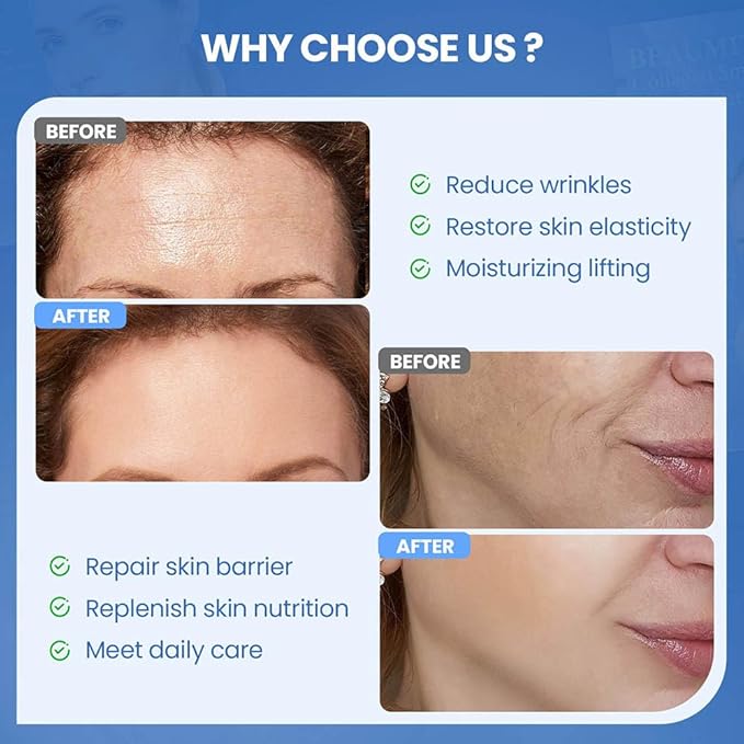 Okela Forehead Wrinkle Patches & Smile Line Patches Overnight, Hydrogel Smoothing Patches Skin Care Gifts for Fine Lines, Deep Line and Firming