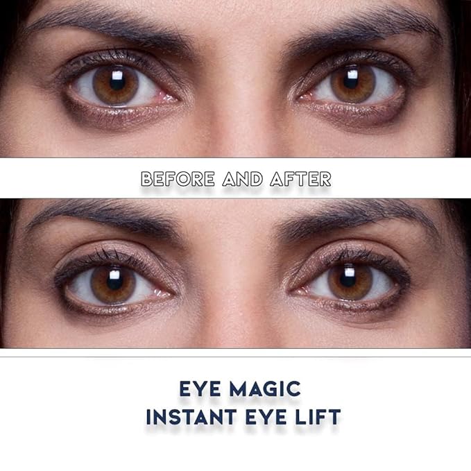 Eye Magic Premium Eye Lift Strips - Small Size, 88 Count Pack, Strips Only (no gel), for Smaller Eyelid Sizes, Instant Non-Surgical Lift, Made in USA