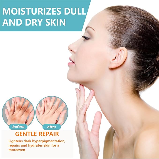Dark Spot Remover For Body,Dark Spot Corrector Cream,- Underarm, Neck, Armpit, Knees, Elbows, Private Areas, Intimate Areas (Acanthosis Nigricans Therapy 2Box)