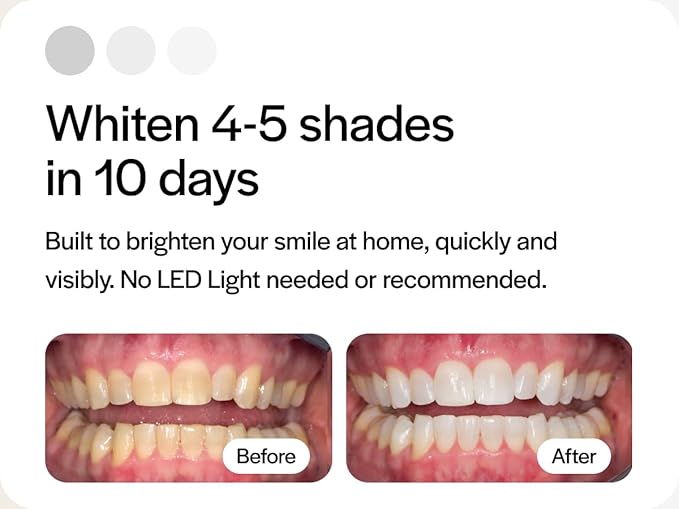 Opalescence 10% Teeth Whitening Kit - Gel Syringes Refills - Low Sensitivy (12 Units) - Fluoride, Carbamide Peroxide - Made in The USA by Ultradent 5211-6