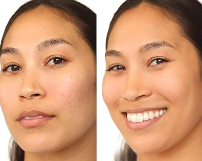RICH - BE YOU SKIN Perfecting Tint with Hydrating Benefits - The Original Skin Perfector from the Creator of per-fekt - Lightweight, Natural Finish veryday Use. Enhance Skin Tone.