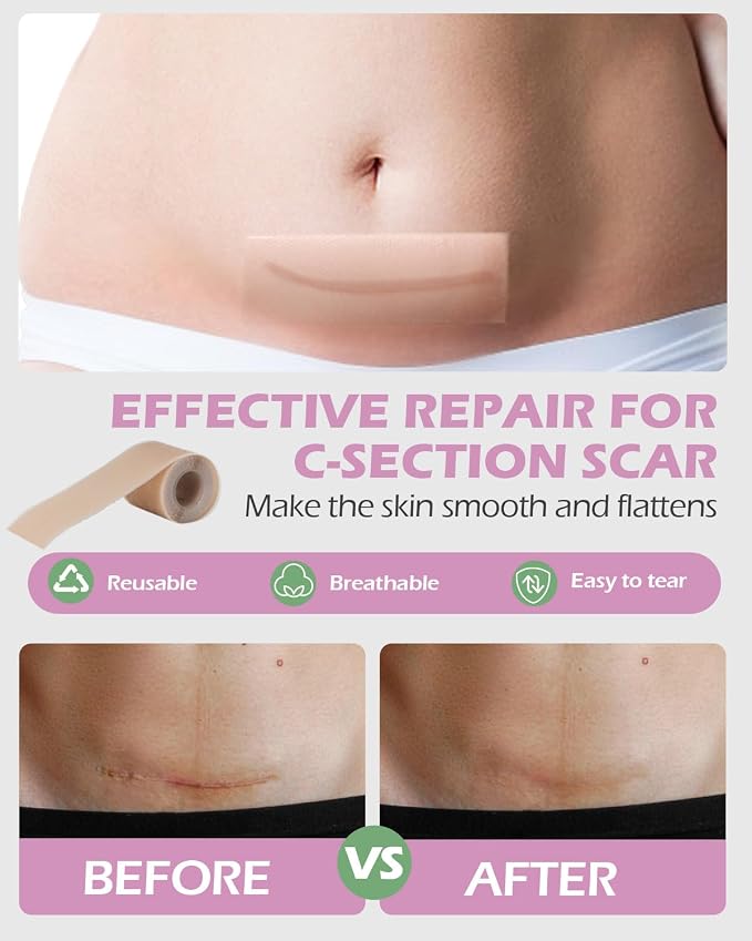 C Section Recovery Kit, Csection Postpartum Essentials | Peri Bottle,6 Disposable Mesh Underwears,Witch Hazel Pad Liners,Silicone Scar Patches, Abdominal Belly Binder,Socks,Card