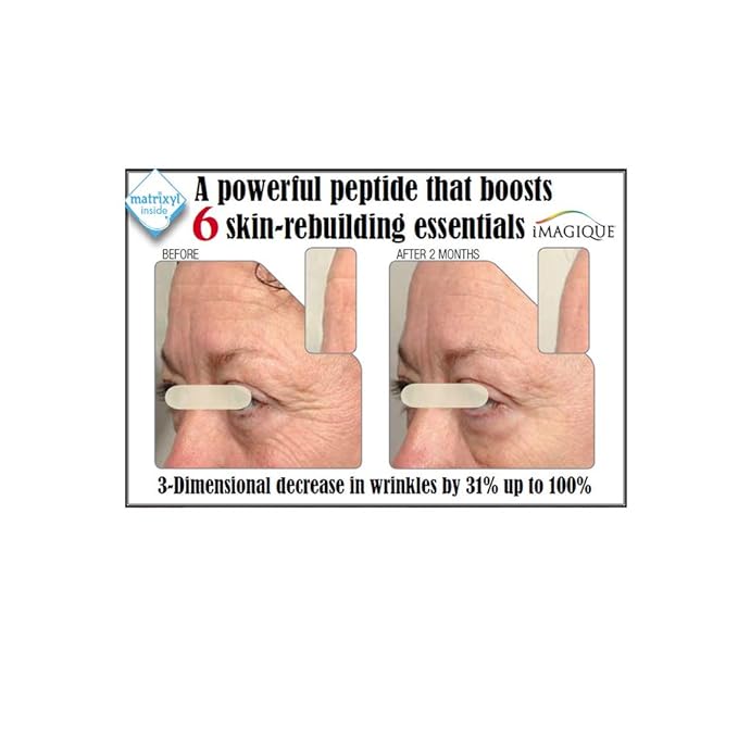 Age-Defying Eye Gel for Dark Circles and Puffiness with Matrixyl®, Haloxyl® & Eyeliss® - Anti-Aging Treatment for Fine Lines & Wrinkles