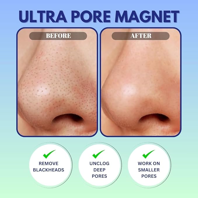 GENDA Blackhead Remover Nose Pore Strips for Deep Cleansing, Clears Black head and Instant Pore Unclogging - 12 Strips