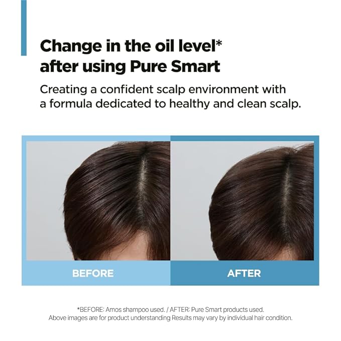 AMOS PROFESSIONAL Pure Smart Shampoo Deep Action l Clarifying Shampoo for Dandruff, build-up and Dirt, For Oil & Flake Control, 16.9 fl. oz.