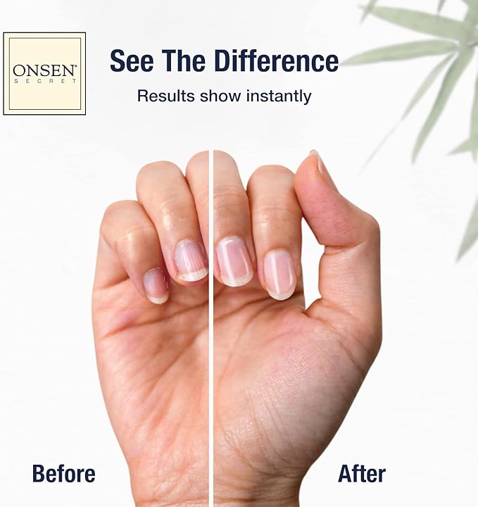 Onsen Secret Nail Care Kit - Includes Cuticle Oil 10ml, Japanese Nail Buffer and Shine Kit - Spa-Quality Manicure - Organic Ingredients - Long-Lasting Shine - Easy & Safe - 1pk