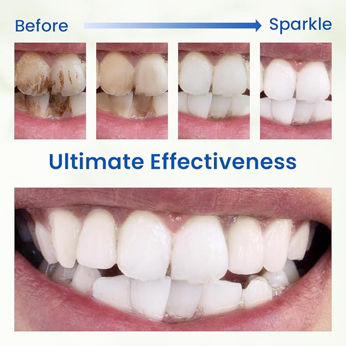 Freshmile Teeth Whitening Powder, Toothpowder Fluoride-Free Hydroxyapatite Formula Enamel Strengthening Gently Cleans & Whitens