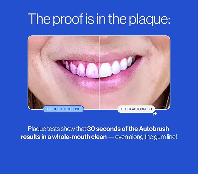 Autobrush Fluoride-Free Foaming Toothpaste for Adults, Mint Flavor, Whitening & Deep Cleaning, Travel Friendly, Anti-Cavity (Pack of 3)