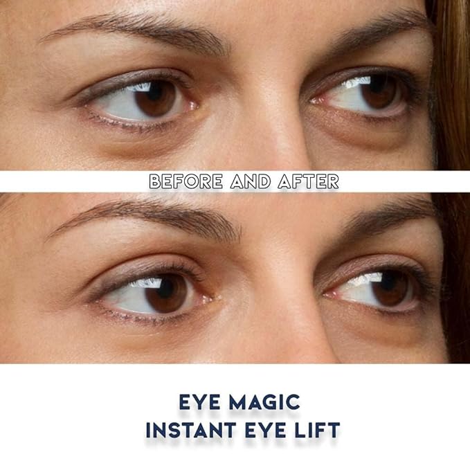Eye Magic Premium Instant Eyelid Lift (L/XL-Refill). Look Younger Instantly | Made in America - Lifts and Defines Droopy, Sagging, Hooded Eyelids For A Youthful Look
