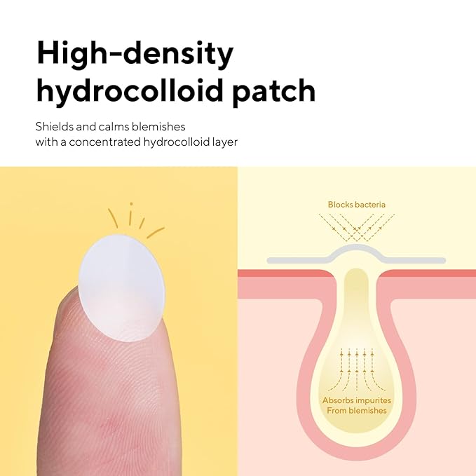 caraseoul Pimple Patches, 2 Size Hydrocolloid Acne Patch for Zits and Blemishes, Bakuchiol & Aloe Vera, Korean Skin Care, Easy to Use – Dermatology Tested