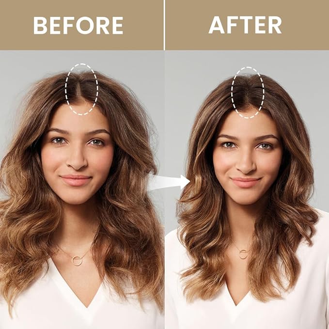 VOLLUCK Root Touch up Powder, Instant Hairline Powder for Thinning Areas and Gray Hair Coverage, Natural and Non-greasy Root Cover up for Women and Men (Dark Blonde, 0.14 Ounce)