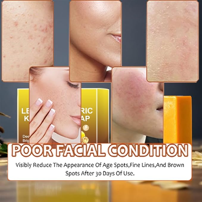 Jabon de Curcuma Para las Manchas, Acido Kojico para Manchas, Jabón de Curcuma, Aceite de Coco, Vitamina E, Triple Para Rostro y Cuerpo, Jabón Para Piel Grasa y Seca (1 Jabon Intimo Para Mujer)