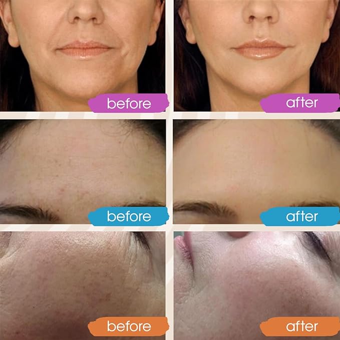GLEOW Retinol Serum for Face, Vitamin C with Hyaluronic Acid Face Serum for Women and Men, Glow Total Package Skin Care Set, Targets Appearance of Uneven Skin Tone and Dryness 3x2 oz
