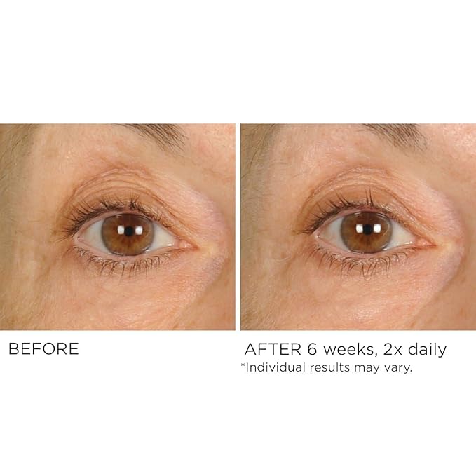 NASSIFMD Under Eye Smoother Firming Cream, Anti-Aging Eye Cream for Dark Circles, Puffiness & Wrinkles