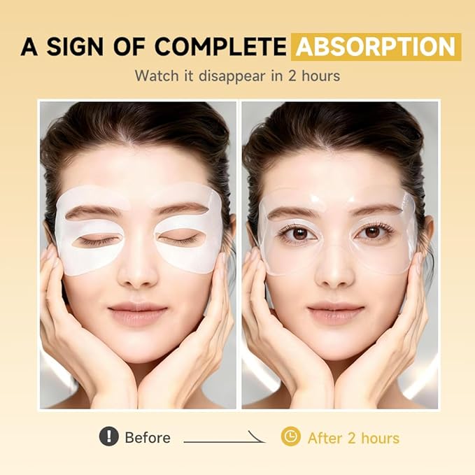 8 Pairs 5% PDRN Under Eye Patches, 6-in-1 Bio-Collagen 360° Eye Patches for puffy eyes, dark circles & Wrinkle | 2% Caffeine, Kojic acid, Retinol, Hyaluronic, Niacinamide | Korean Eye Care