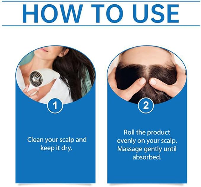 Scalp Serum for Hair Growth, Hair Serum, Scalpy Hair Growth Serum, Nourishing Hair Treatment Essence, Exfoliates Dandruff & Soothes Itch for men & women (1PCS)