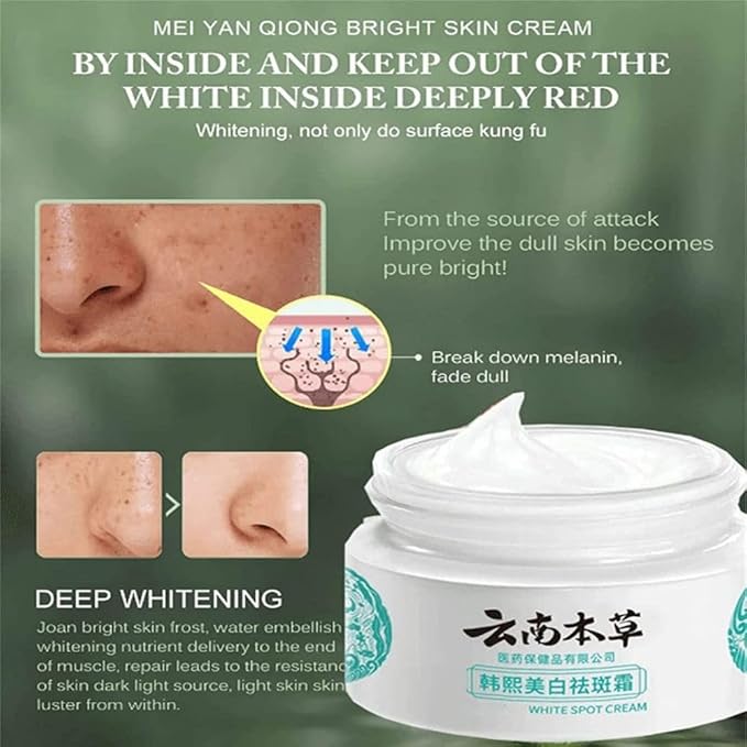 Japanese Melasma Cream, JP Yunnan Herbal White Spot Cream, Keting Face Cream, Face Moisturizing Face Skin Care (5pcs)