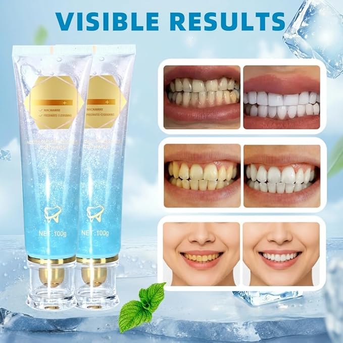 2Pack Niacinamide Whitening Toothpaste,Remove Tooth Stains,Niacinamide Intensive Toothpaste,Protects Tooth Enamel，Freshens Breath 24 Hours.