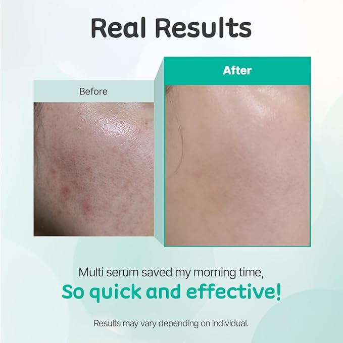 KIFT Multi-Solution Face & Eye Serum - Hydrating, Smoothing, and Soothing K-Beauty Skincare Serum for Radiant, Nourished Skin, 30ml