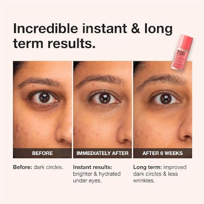 NAPH iNNBEAUTY PROJECT Bright & Tight Dark Circle Firming Eye Cream with Vitamin C & Peptides (0.5 oz / 15 mL) + Bonus Acne Patch (36 Pieces)
