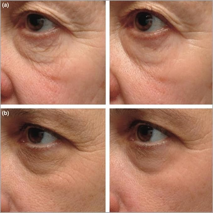 Instant Firming Eye Serum|Anti-Aging Formula for Under Bags and Wrinkles, Under Eye Cream-10ml, Wrinkle Filler, Visibly Improves for Bags Dark Circles Treatment for Puffines (Perfume Free)