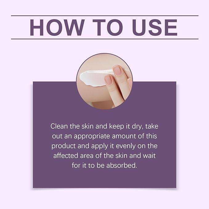 Vitiligo Cream, Vitiligo Treatment Cream， Reduce White Spots，Easy to Use