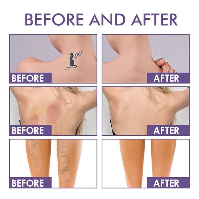 Body Coverage Perfector 2PCS Waterproof Leg & Body Makeup Tattoo Cover Up Makeup Natural Radiance