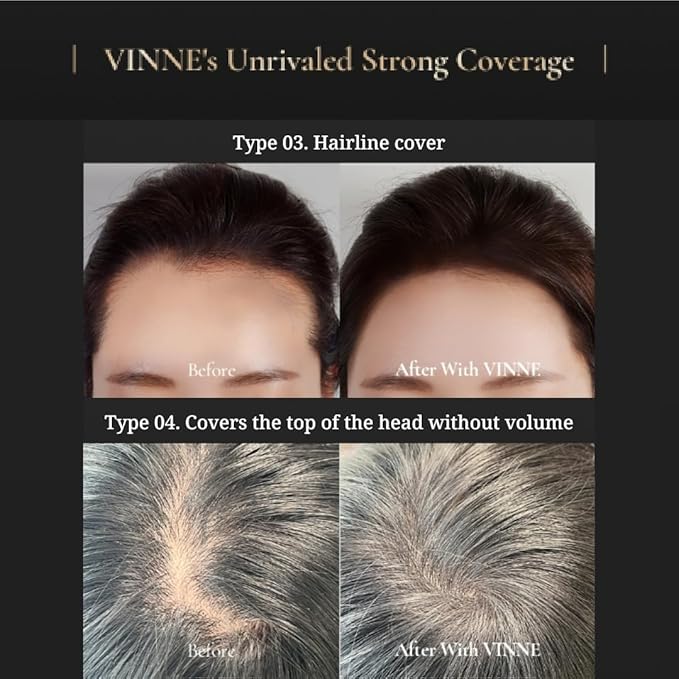 Vinne 2-Color Hair Cushion Stick: Waterproof Gray Cover, Hair Concealer, Long-Lasting Root Filler & Nutrient-Rich Care (Natural Black, Dark Brown)