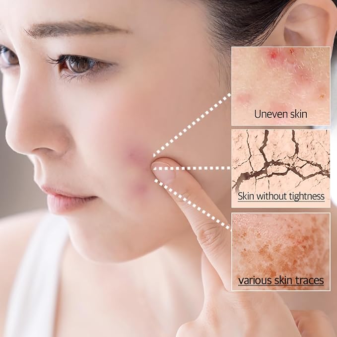 Centella Asiatica Soothing Gel Cream – 68% Madagascar Cica Madecassoside Daily Moisturizer for Sensitive Skin – Calming Face Cream with Ceramide – Fragrance Free Korean Skincare