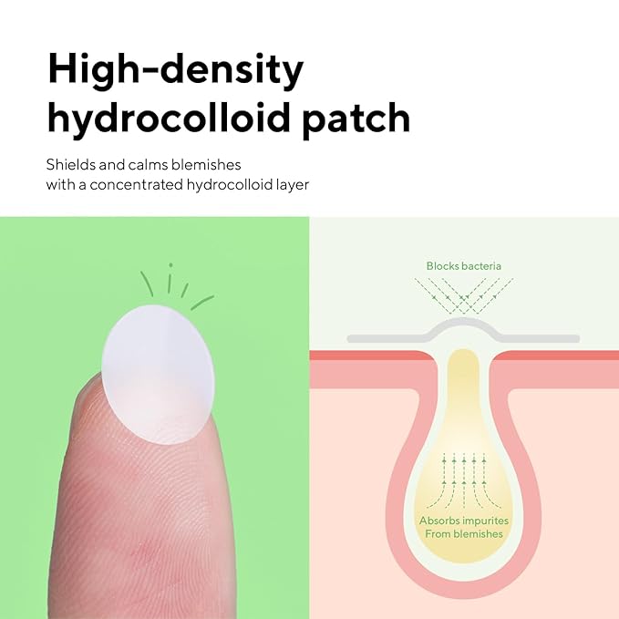 caraseoul Pimple Patches, 2 Size Hydrocolloid Acne Patch for Zits and Blemishes, Bakuchiol & Aloe Vera, Korean Skin Care, Easy to Use – Dermatology Tested