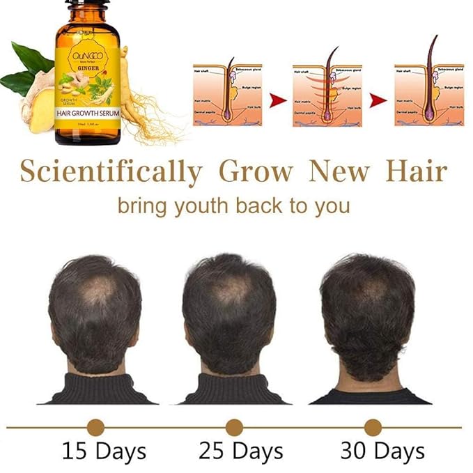 5 PACK Hair Growth Serum Liquid Hair Loss Treatment for Women & Men Dense Thicken Hair,Natural Ginger Essential Oil - Promotes Strong, Thick,Strengthens Hair - Nourishment For All Hair Types